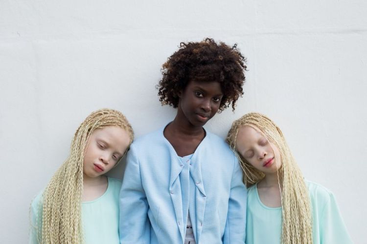 albino-twins-models-sister